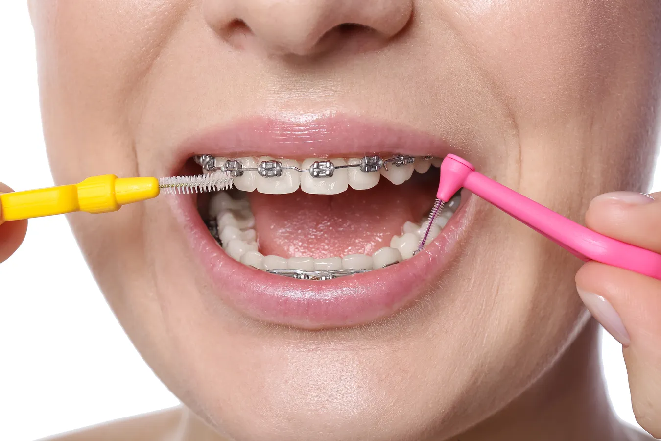 Stomatolog Kędzierzyn Koźle