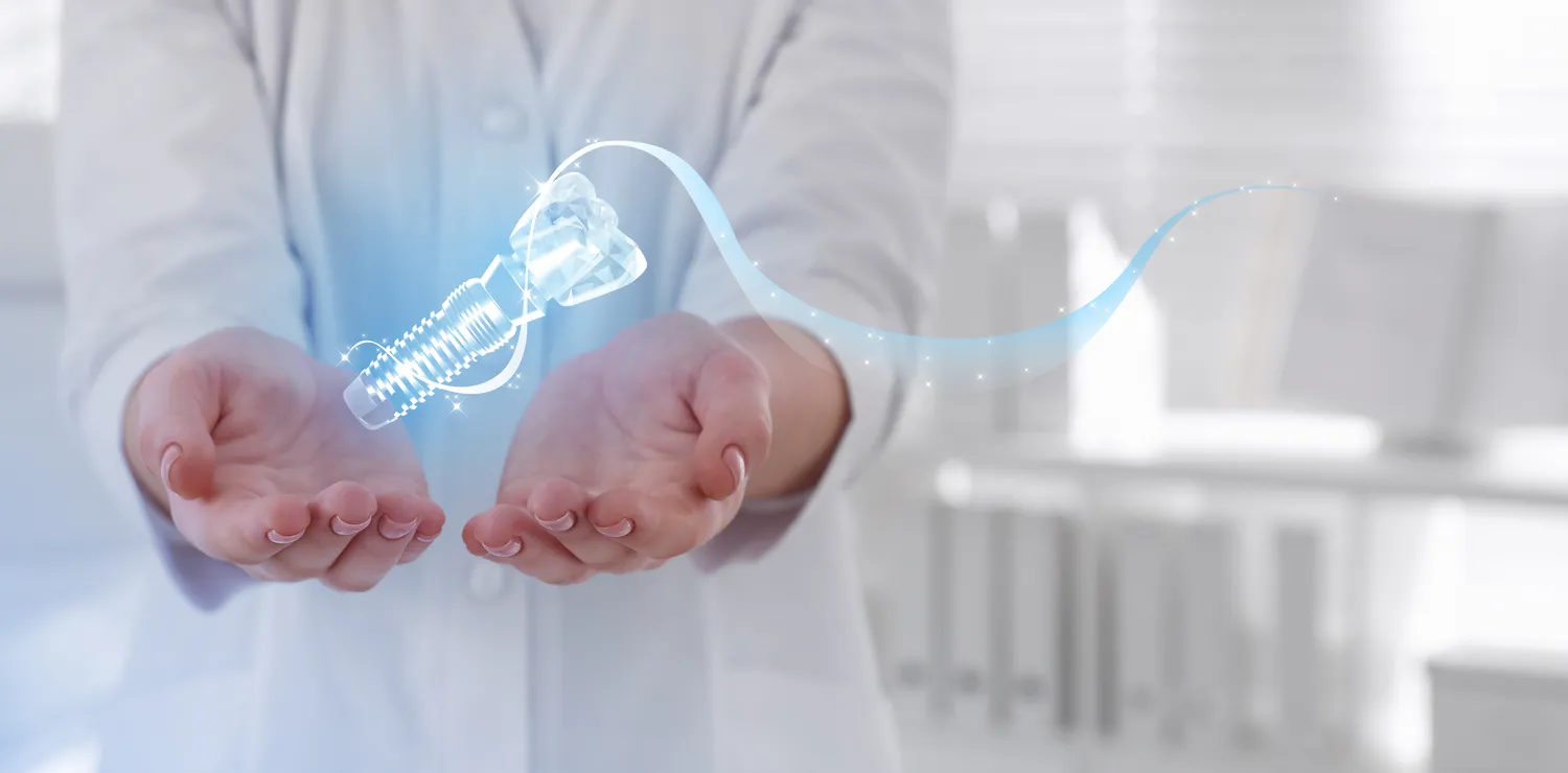 Rodzaje implantów zębowych