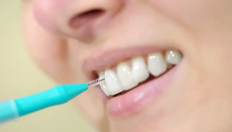 Ile trwa kanałowe leczenie zęba?