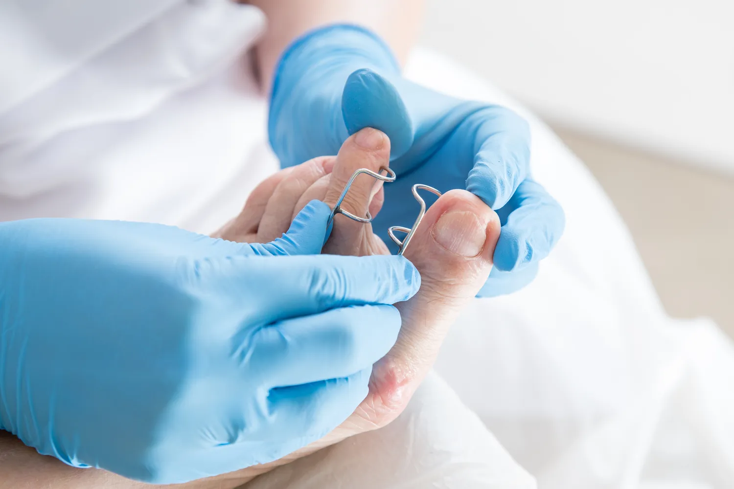 Zadbaj o swoje stopy już dziś - podologia na ratunek